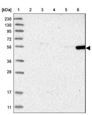 Western Blot: FRS3 Antibody [NBP1-83421]