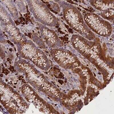 Immunohistochemistry-Paraffin: FRY Antibody [NBP2-14510]