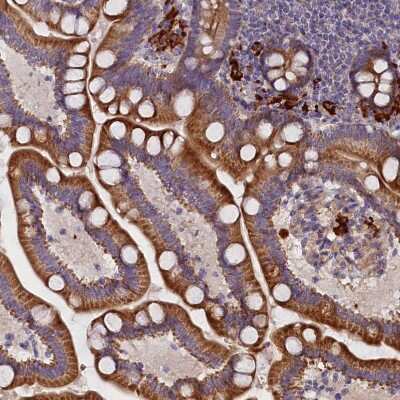 Immunohistochemistry-Paraffin: FRY Antibody [NBP2-14510]