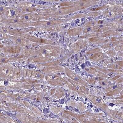Immunohistochemistry-Paraffin: FRY Antibody [NBP2-14510]