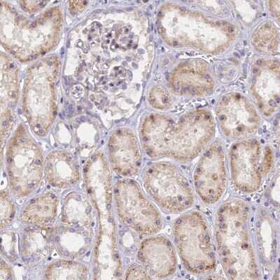 Immunohistochemistry-Paraffin: FRY Antibody [NBP2-14510]
