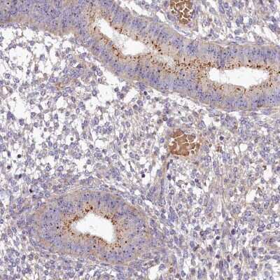 Immunohistochemistry-Paraffin: FRY Antibody [NBP2-14510]