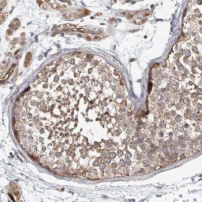 Immunohistochemistry-Paraffin: FRYL Antibody [NBP1-94070]