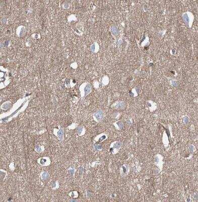 Immunohistochemistry-Paraffin: FRYL Antibody [NBP1-94071]