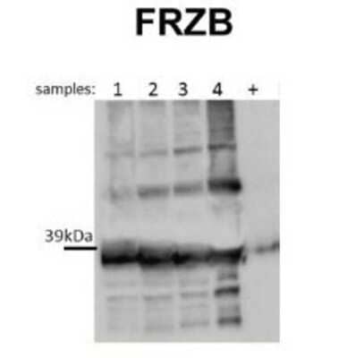 Western Blot: sFRP-3/FRZB Antibody [NBP1-79551]