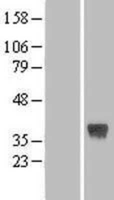 Western Blot: sFRP-3/FRZB Overexpression Lysate [NBL1-10839]