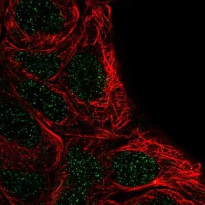 Immunocytochemistry/ Immunofluorescence: FSBP Antibody [NBP2-55242]