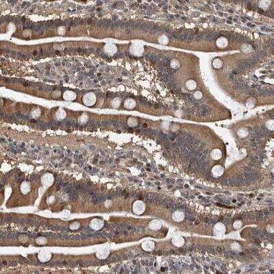 Immunohistochemistry-Paraffin: FSBP Antibody [NBP2-76996]