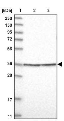 Western Blot: FSBP Antibody [NBP2-76996]