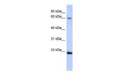 Western Blot: FSBP Antibody [NBP2-84944]