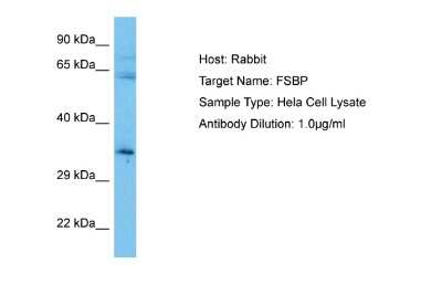 Western Blot: FSBP Antibody [NBP2-84945]