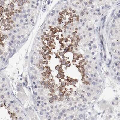 Immunohistochemistry-Paraffin: FSCB Antibody [NBP1-88417]