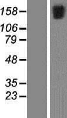 Western Blot: FSCB Overexpression Lysate [NBP2-06074]