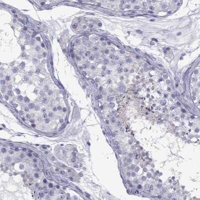 Immunohistochemistry-Paraffin: FSCN3 Antibody [NBP3-17125]
