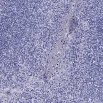 Immunohistochemistry-Paraffin: FSCN3 Antibody [NBP3-17125]