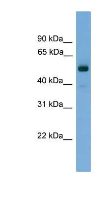 Western Blot: FSCN3 Antibody [NBP1-79542]