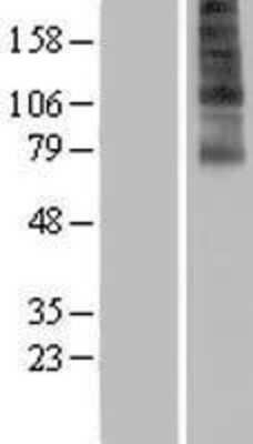 Western Blot: FSCN3 Overexpression Lysate [NBP2-06657]