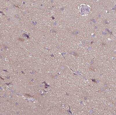 Immunohistochemistry-Paraffin: FSD1 Antibody [NBP1-81123]