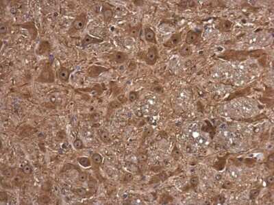 Immunohistochemistry-Paraffin: FSD1 Antibody [NBP3-13039]