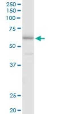 Western Blot: FSD1 Antibody [H00079187-B01P]