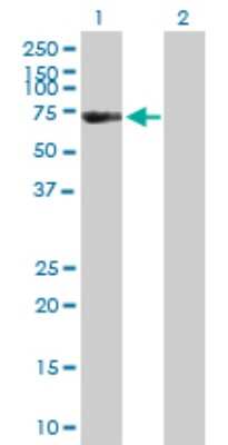 Western Blot: FSD1 Antibody [H00079187-B01P]