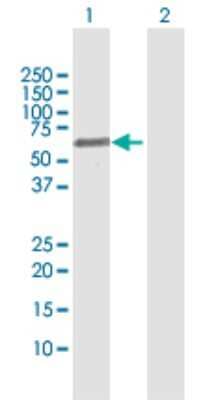 Western Blot: FSD1 Antibody [H00079187-D01P]