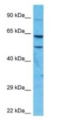 Western Blot: FSD1 Antibody [NBP3-09408]