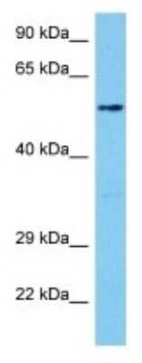 Western Blot: FSD1 Antibody [NBP3-10100]