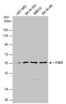 Western Blot: FSD1 Antibody [NBP3-13039]