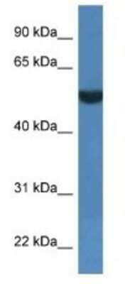 Western Blot: FSD1L Antibody [NBP1-79841]