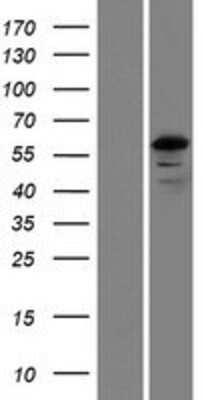 Western Blot: FSD1L Overexpression Lysate [NBP2-09736]