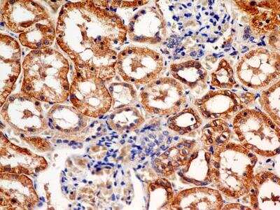 Immunohistochemistry-Paraffin: FSHR Antibody (6E8.2F5) - BSA Free [NBP2-36489]
