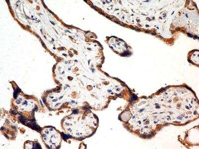 Immunohistochemistry-Paraffin: FSHR Antibody (6E8.2F5) - BSA Free [NBP2-36489]