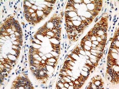 Immunohistochemistry-Paraffin: FSHR Antibody (6E8.2F5) - BSA Free [NBP2-36489]