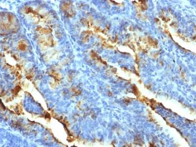 Immunohistochemistry-Paraffin: FSHR Antibody (FSHR/1400) - Azide and BSA Free [NBP2-54329]