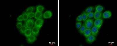 Immunocytochemistry/ Immunofluorescence: FSHR Antibody [NBP2-16537]