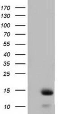 Western Blot: FSH beta Antibody (OTI2A6) [NBP2-02909]