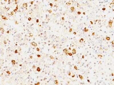 Immunohistochemistry-Paraffin: FSH beta Antibody (FSHb/1062) - Azide and BSA Free [NBP2-47734]