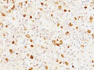 Immunohistochemistry-Paraffin: FSH beta Antibody (FSHb/1062) [NBP2-45132]