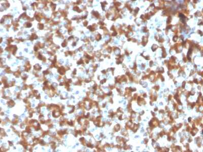 Immunohistochemistry-Paraffin: FSH beta Antibody (FSHb/2033R) - Azide and BSA Free [NBP3-08577]