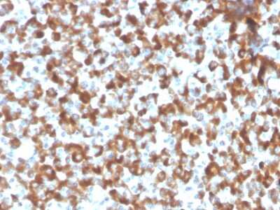 Immunohistochemistry-Paraffin: FSH beta Antibody (FSHb/2033R) [NBP3-07794]