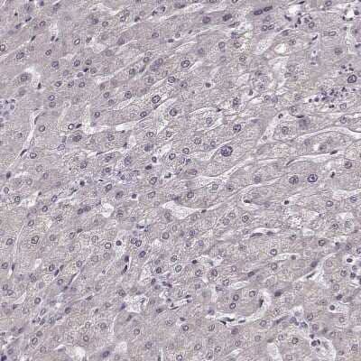 Immunohistochemistry-Paraffin: FSH beta Antibody [NBP2-57723]
