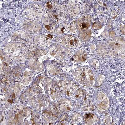 Immunohistochemistry-Paraffin: FSH beta Antibody [NBP2-57723]