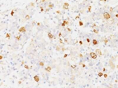 Immunohistochemistry-Paraffin: FSH beta Antibody (SPM107) - Azide and BSA Free [NBP2-47735]