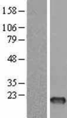 Western Blot: FSH beta Overexpression Lysate [NBL1-10844]