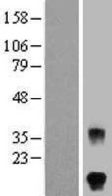 Western Blot: FSH beta Overexpression Lysate [NBP2-10680]