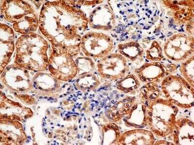 Immunohistochemistry-Paraffin: FSHR Antibody (6E8.2F5) - Azide and BSA Free [NBP2-80743]