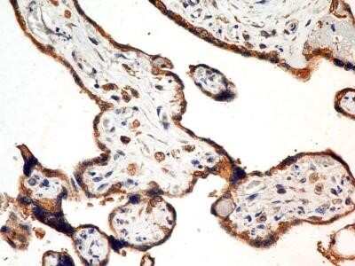 Immunohistochemistry-Paraffin: FSHR Antibody (6E8.2F5) - Azide and BSA Free [NBP2-80743]