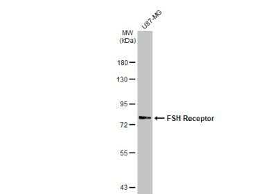 Western Blot: FSHR Antibody [NBP2-16537]