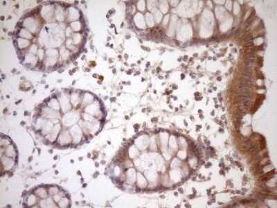 Immunohistochemistry: FSIP1 Antibody (OTI4F9) [NBP2-45738]